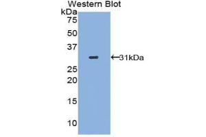 Western blot analysis of the recombinant protein. (STAT2 antibody  (AA 616-849))