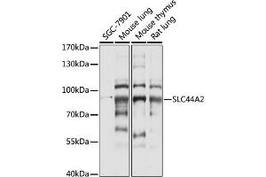Western blot analysis of extracts of various cell lines, using SLC44 antibody (ABIN7270464) at 1:1000 dilution. (SLC44A2 antibody  (AA 150-250))