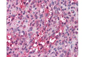 Immunohistochemistry (IHC) image for anti-Apolipoprotein B mRNA Editing Enzyme, Catalytic Polypeptide-Like 3G (APOBEC3G) (AA 51-100) antibody (ABIN6736355)