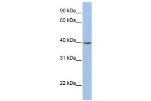 WB Suggested Anti-ZNF202  Antibody Titration: 0.