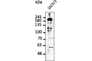 Western Blotting (WB) image for anti-Receptor tyrosine-protein kinase erbB-2 (ErbB2/Her2) (C-Term) antibody (ABIN6254225)