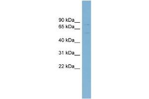 WB Suggested Anti-ABCG5 Antibody Titration: 0. (ABCG5 antibody  (Middle Region))