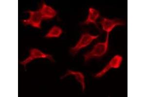ABIN6276145 staining COLO205 by IF/ICC. (OR4A15 antibody  (C-Term))