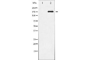 Western blot analysis of VEGFR2 phosphorylation expression in SK-OV3 whole cell lysates,The lane on the left is treated with the antigen-specific peptide. (VEGFR2/CD309 antibody  (pTyr951))