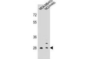 Western Blotting (WB) image for anti-Folate Receptor 2 (Fetal) (FOLR2) antibody (ABIN2998462)