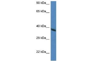 WB Suggested Anti-Hao2 Antibody   Titration: 1. (Hydroxyacid Oxidase 2 (HAO2) (Middle Region) antibody)