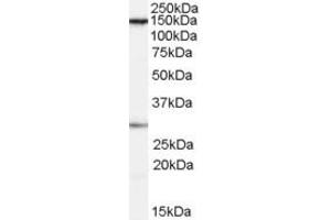Western Blotting (WB) image for anti-FACT complex subunit SPT16 (SUPT16H) (Internal Region) antibody (ABIN2466335) (SUPT16H antibody  (Internal Region))