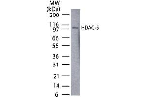 HDAC5 antibody tested by Western blot. (HDAC5 antibody  (AA 572-587))