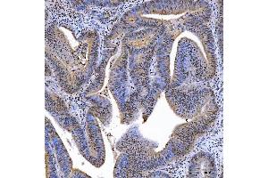 IHC analysis of SAE1 using anti-SAE1 antibody (ABIN7601346). (SAE1 antibody  (AA 33-299))