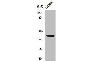 Western Blot analysis of COLO205 cells using KKIALRE Polyclonal Antibody