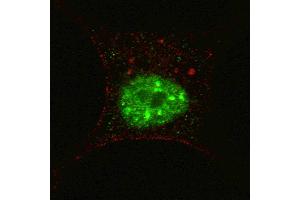 Fluorescent confocal image of SY5Y cells stained with phospho-STAT3- antibody. (STAT3 antibody  (pSer727))