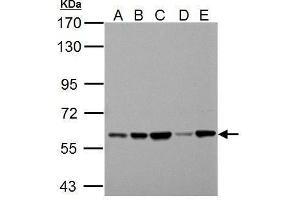 WB Image Sample (30 ug of whole cell lysate)    A: 293T   B: A431   C: HeLa   D: HepG2   E: A375   7. (Pyruvate Kinase antibody  (Center))