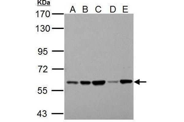 Pyruvate Kinase antibody  (Center)