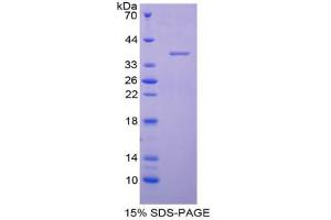 SDS-PAGE analysis of Human AQP1 Protein. (Aquaporin 1 Protein)