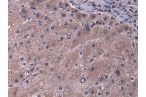 Detection of ABCB11 in Human Liver Tissue using Polyclonal Antibody to ATP Binding Cassette Transporter B11 (ABCB11) (ABCB11 antibody  (AA 421-663))