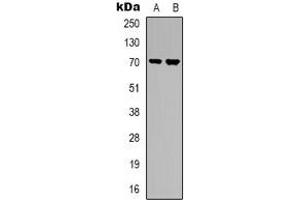 Western blot analysis of S6K1 expression in HepG2 (A), Jurkat (B) whole cell lysates. (RPS6KB1 antibody)