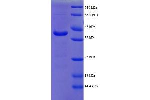 SDS-PAGE (SDS) image for ATP Synthase gamma Chain 1 (ATPC1) (AA 43-161), (partial) protein (GST tag) (ABIN5712073) (ATPC1 Protein (AA 43-161, partial) (GST tag))