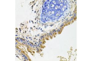 Immunohistochemistry of paraffin-embedded mouse lung using GP2 antibody (ABIN5975023) at dilution of 1/100 (40x lens). (GP2 antibody)