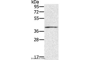 Western blot analysis of Mouse muscle tissue, using IFNGR2 Polyclonal Antibody at dilution of 1:200 (IFNGR2 antibody)