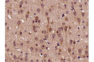 Paraformaldehyde-fixed, paraffin embedded mouse brain, Antigen retrieval by boiling in sodium citrate buffer (pH6) for 15min, Block endogenous peroxidase by 3% hydrogen peroxide for 30 minutes,  Blocking buffer (normal goat serum) at 37°C for 20min, Antibody incubation with Biglycan Polyclonal Antibody (bs-7552R) at 1:400 overnight at 4°C, followed by a conjugated secondary and DAB staining. (Biglycan antibody  (AA 101-200))