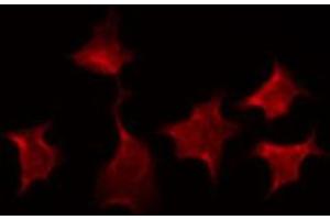 ABIN6266678 staining HepG2 by IF/ICC. (XRCC3 antibody  (N-Term))