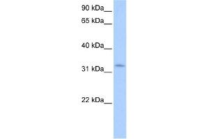WB Suggested Anti-NRIP2 Antibody Titration:  0.