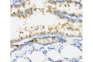 Immunohistochemistry of paraffin-embedded Mouse lung using IFNL3 Polyclonal Antibody at dilution of 1:100 (40x lens). (IL28B antibody)