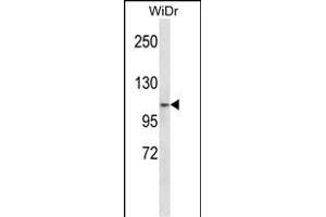 ZN Antibody (N-term) (ABIN657545 and ABIN2846560) western blot analysis in WiDr cell line lysates (35 μg/lane). (ZNF836 antibody  (N-Term))