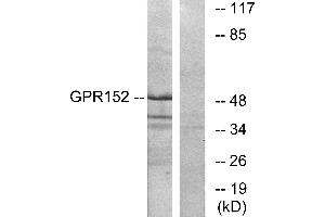 Western blot analysis of extracts from Jurkat cells, using GPR152 antibody. (GPR152 antibody  (N-Term))