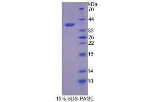 SDS-PAGE analysis of Human SCGB2A2 Protein.