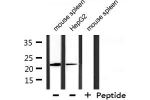 Western blot analysis of extracts from mouse spleen, HepG2, using DIRA1 Antibody. (DIRAS1 antibody  (C-Term))