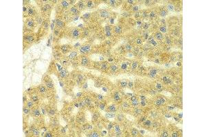 Immunohistochemistry of paraffin-embedded Rat liver using ADCK3 Polyclonal Antibody at dilution of 1:100 (40x lens). (COQ8A antibody)