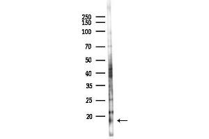 anti-Fatty Acid Binding Protein 2, Intestinal (FABP2) (C-Term) antibody