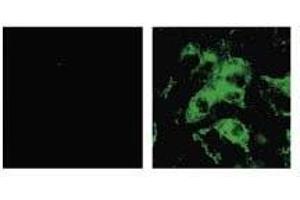 Immunofluorescence (IF) image for anti-SARS-Coronavirus Spike Protein (SARS-CoV S) antibody (ABIN2452119) (SARS-CoV Spike antibody)