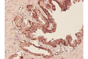 Immunostaining (ISt) image for anti-phosphoglycerate Dehydrogenase (PHGDH) (AA 1-533) antibody (ABIN565240)
