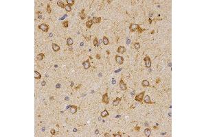 Immunohistochemistry of paraffin-embedded rat brain tissue using SCTR antibody at dilution of 1:200 (x400 lens) (SCTR antibody)