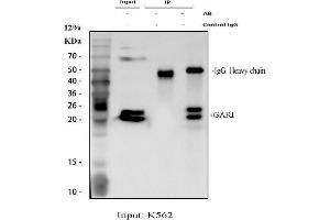 anti-GAR1 Ribonucleoprotein Homolog (Yeast) (GAR1) (AA 58-165) antibody