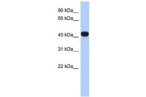 RASGEF1C antibody used at 1 ug/ml to detect target protein. (RASGEF1C antibody  (N-Term))