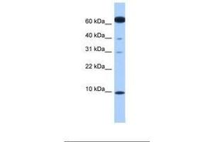 Image no. 1 for anti-Dynein, Light Chain, LC8-Type 1 (DYNLL1) (N-Term) antibody (ABIN6738836) (DYNLL1 antibody  (N-Term))
