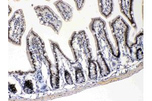 Immunohistochemistry (IHC) image for anti-E2F Transcription Factor 4, P107/p130-Binding (E2F4) (AA 106-144), (N-Term) antibody (ABIN4886566)