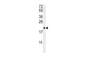 Western blot analysis in NCI-H460 cell line lysates (35ug/lane). (PTP4A2 antibody  (AA 32-59))