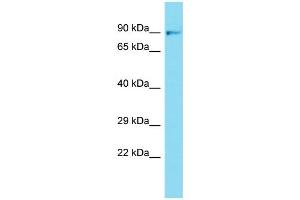 Western Blotting (WB) image for anti-Fibroblast Growth Factor Receptor 1 (FGFR1) (N-Term) antibody (ABIN2440842) (FGFR1 antibody  (N-Term))