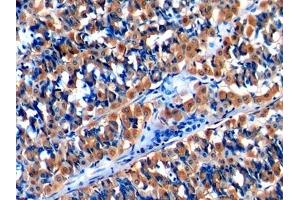 Detection of MCP1 in Human Stomach Tissue using Polyclonal Antibody to Monocyte Chemotactic Protein 1 (MCP1) (CCL2 antibody  (AA 24-99))