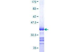 STK32B Protein (AA 314-414) (GST tag)