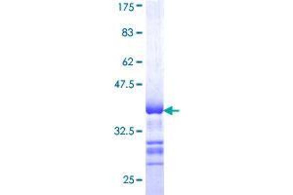 STK32B Protein (AA 314-414) (GST tag)