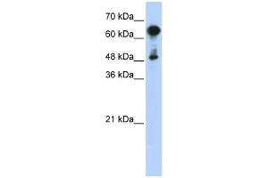 HSPA6 antibody used at 1 ug/ml to detect target protein.