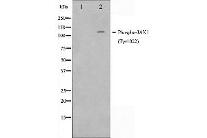 Western blot analysis of JAK1 phosphorylation expression in A549 whole cell lysates,The lane on the left is treated with the antigen-specific peptide.
