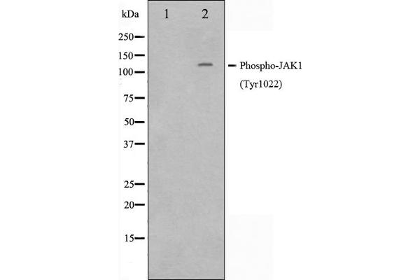 JAK1 antibody  (pTyr1022, pTyr1023)