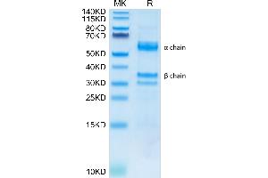 HGF Protein (AA 32-728) (His tag)