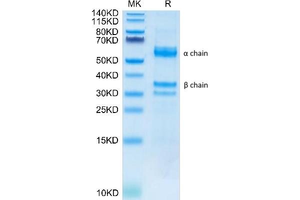 HGF Protein (AA 32-728) (His tag)